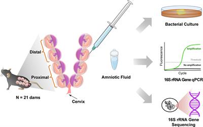 Does the Amniotic Fluid of Mice Contain a Viable Microbiota?